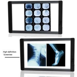 Ymy0919d Super Thin Dental Medical Panel LED X-ray Viewer Negatoscope with LCD Screen